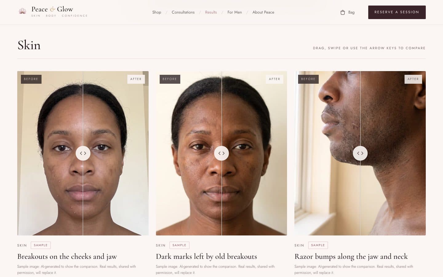 Peace & Glow before and after sliders